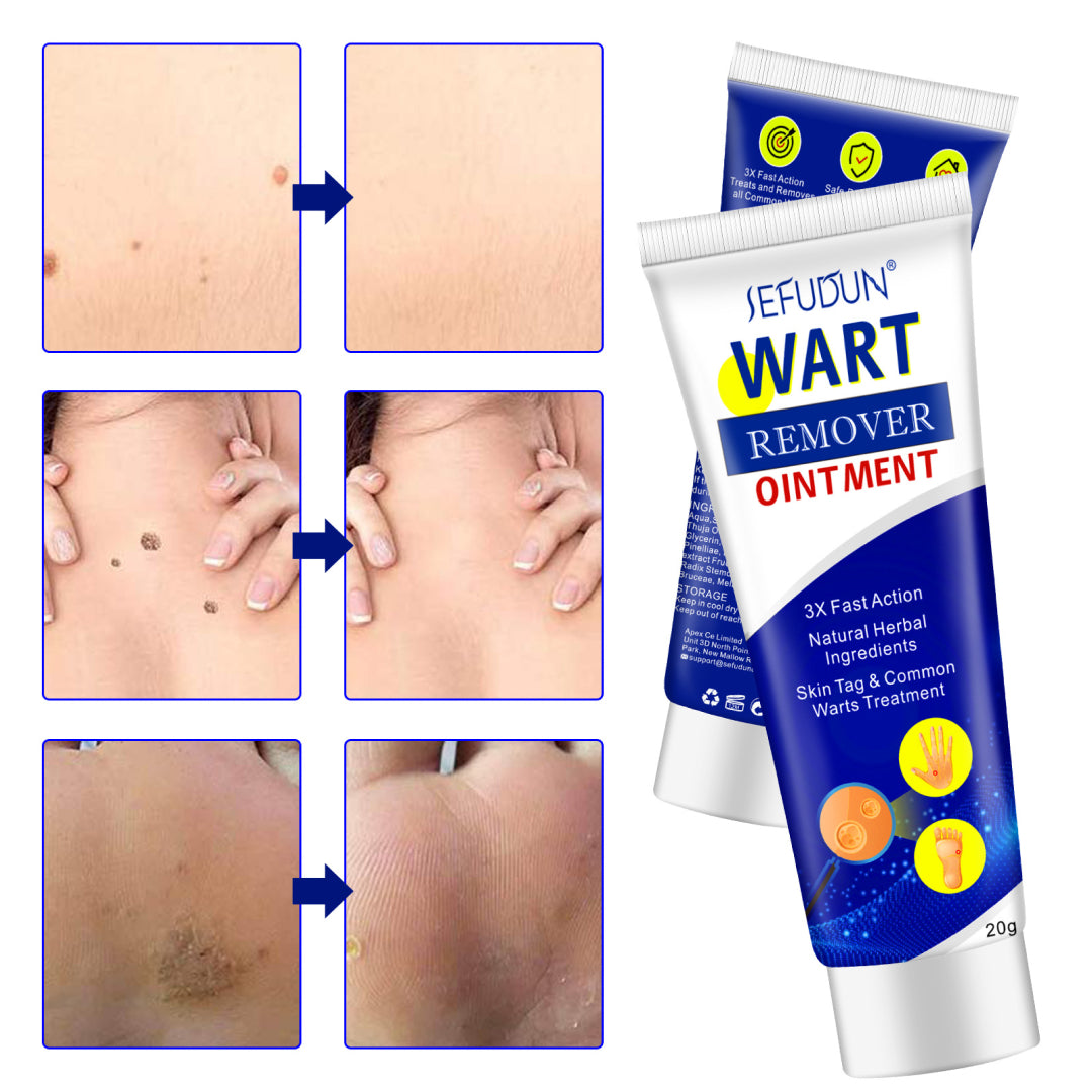 SEFUDUN Skin Tag & Wart Removal Cream, 20g