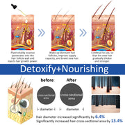 PEGCIZ Scalp Serum for Hair Growth, 30ml