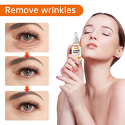 SEFUDUN Turmeric Serum for Dark Spots, 30ml