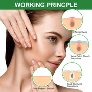 Elaimei Removal Acne Pimple Patches Treatment