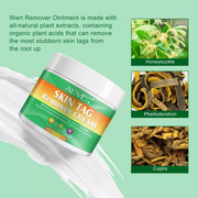 ALIVER Skin Tag, Acne & Wart Remover Cream, 100g