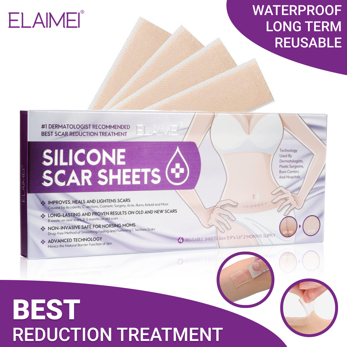 ELAIMEI Silicone Scar Gel Sheets Skin Treatment