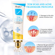 REVIGLAN TCM Scar And Acne Mark Removal Gel Ointment, 30g