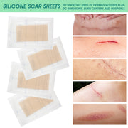 Elaimei Silicone Sheets for Scar Removal
