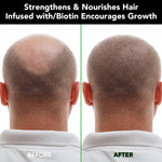 ALIVER Jamaican Black Castor Hair Growth Shampoo, 300ml