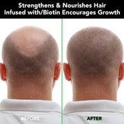 ALIVER Jamaican Black Castor Hair Growth Shampoo, 300ml