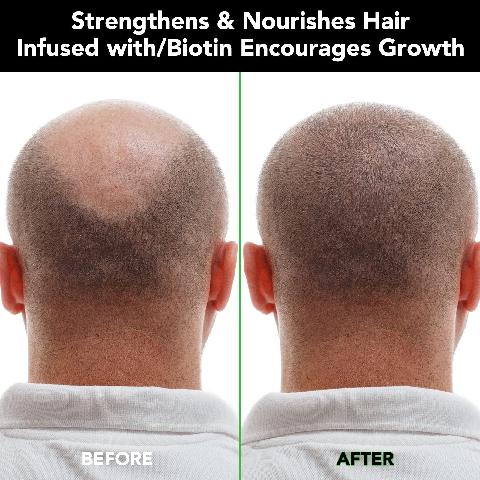 ALIVER Jamaican Black Castor Hair Growth Shampoo, 300ml