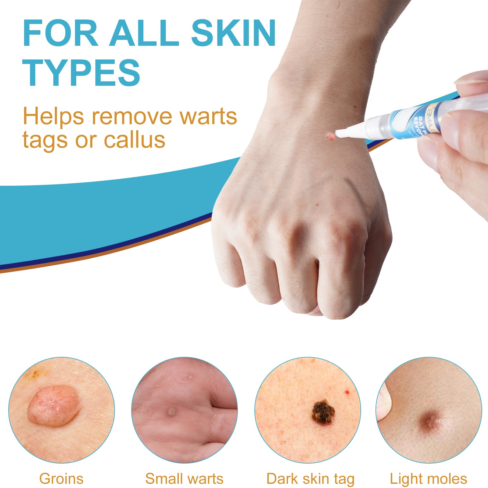 ELAIMEI Skin Tag Remover Kit, Anti Mole & Wart Body Pens, 4pcs