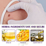 ALIVER Safe Skin Tag Removal Liquid, 30ml