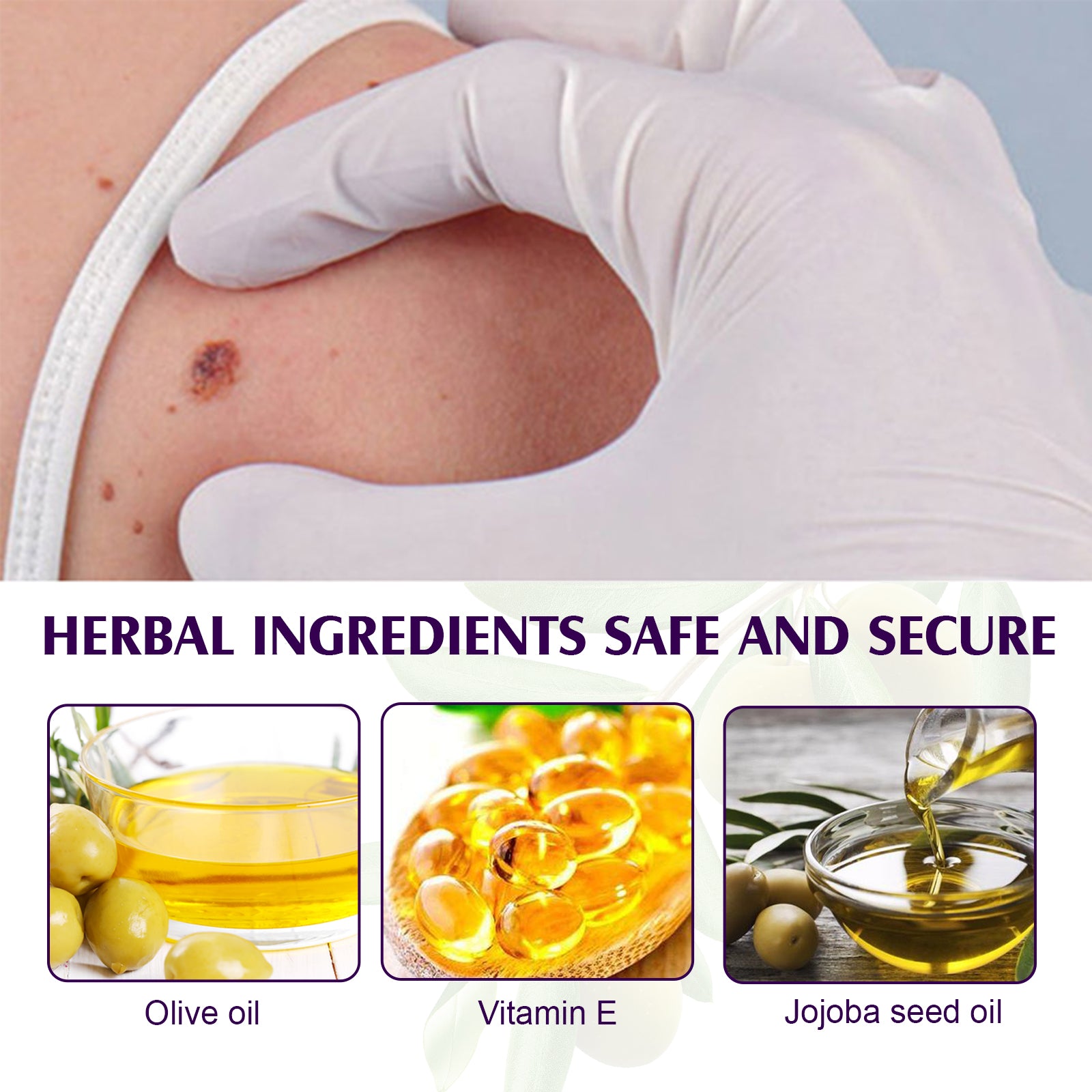 ALIVER Safe Skin Tag Removal Liquid, 30ml