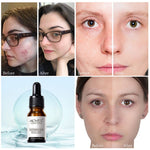 ALIVER Lactobionic Acid Face Serum, 10ml