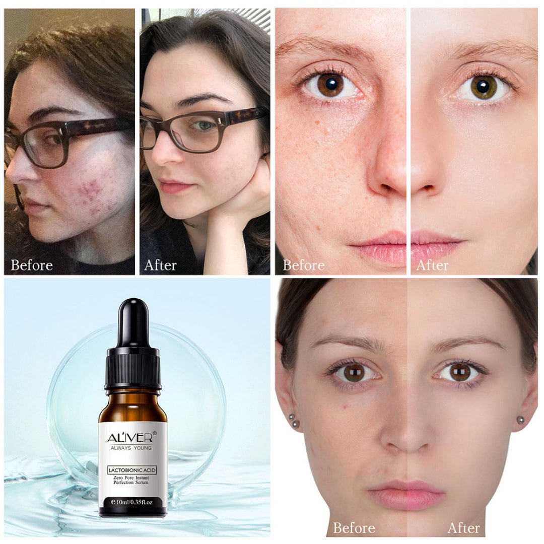ALIVER Lactobionic Acid Face Serum, 10ml