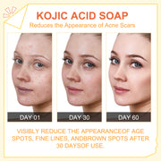 ELAIMEI Papaya Kojic Acid Soap for Face and Body, 100g