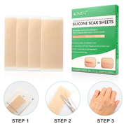 ALIVER Silicone Scar Sheets, Reduction Treatment, pack of 4pcs