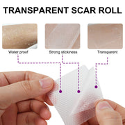 Elaimei Silicone Scar Removal Gel Tape Roll for Skin Treatment Repair 1.5 m