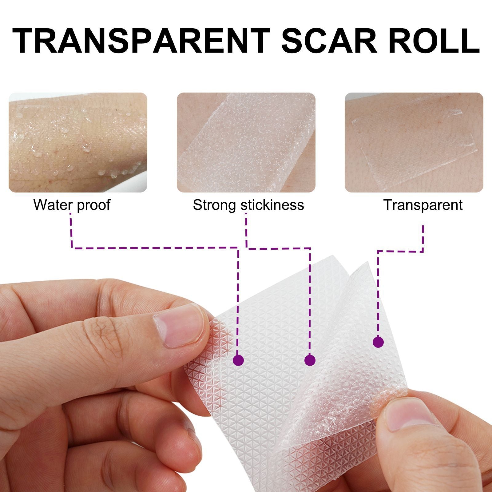 Elaimei Silicone Scar Removal Gel Tape Roll for Skin Treatment Repair 1.5 m