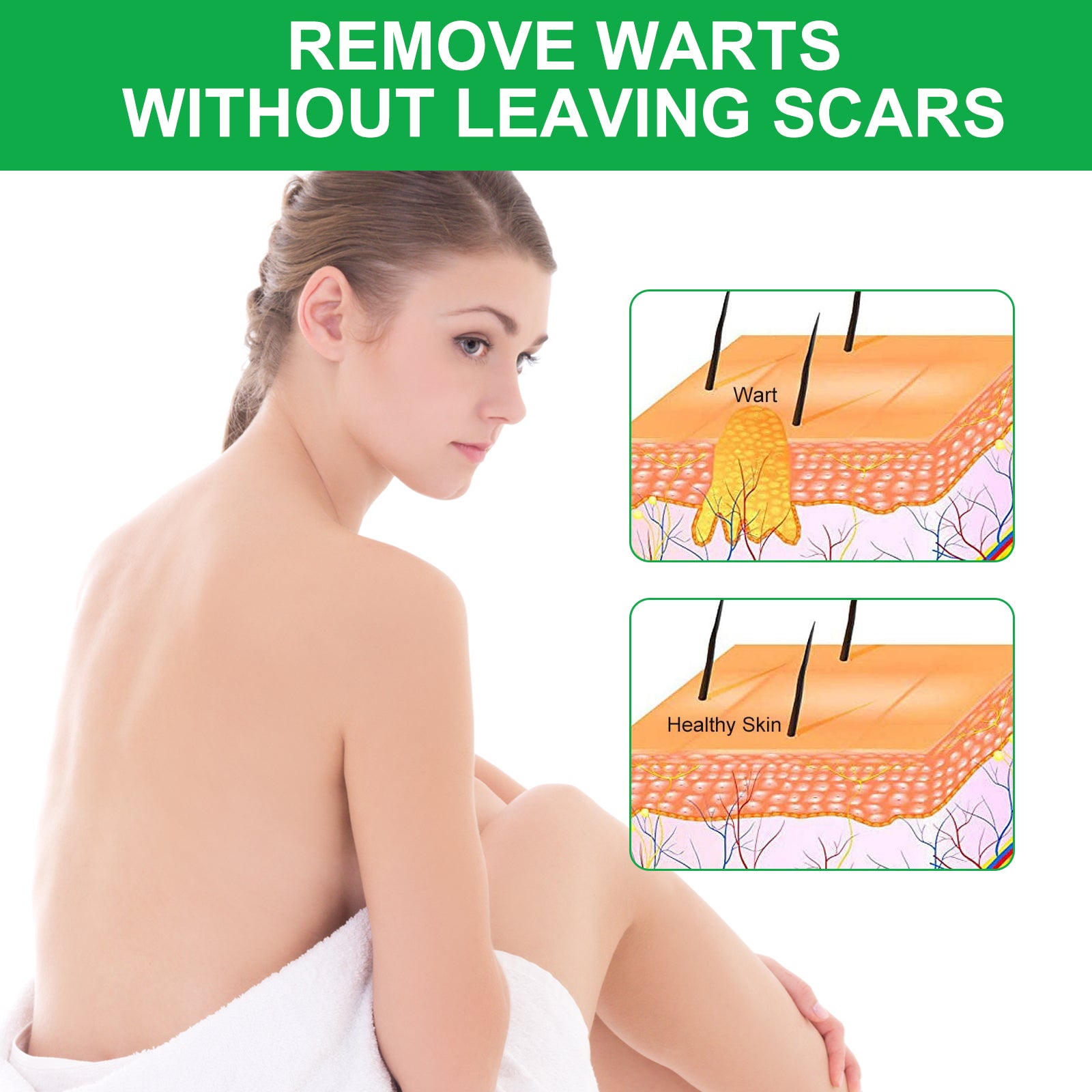 ALIVER Skin Tag, Acne & Wart Remover Cream, 100g