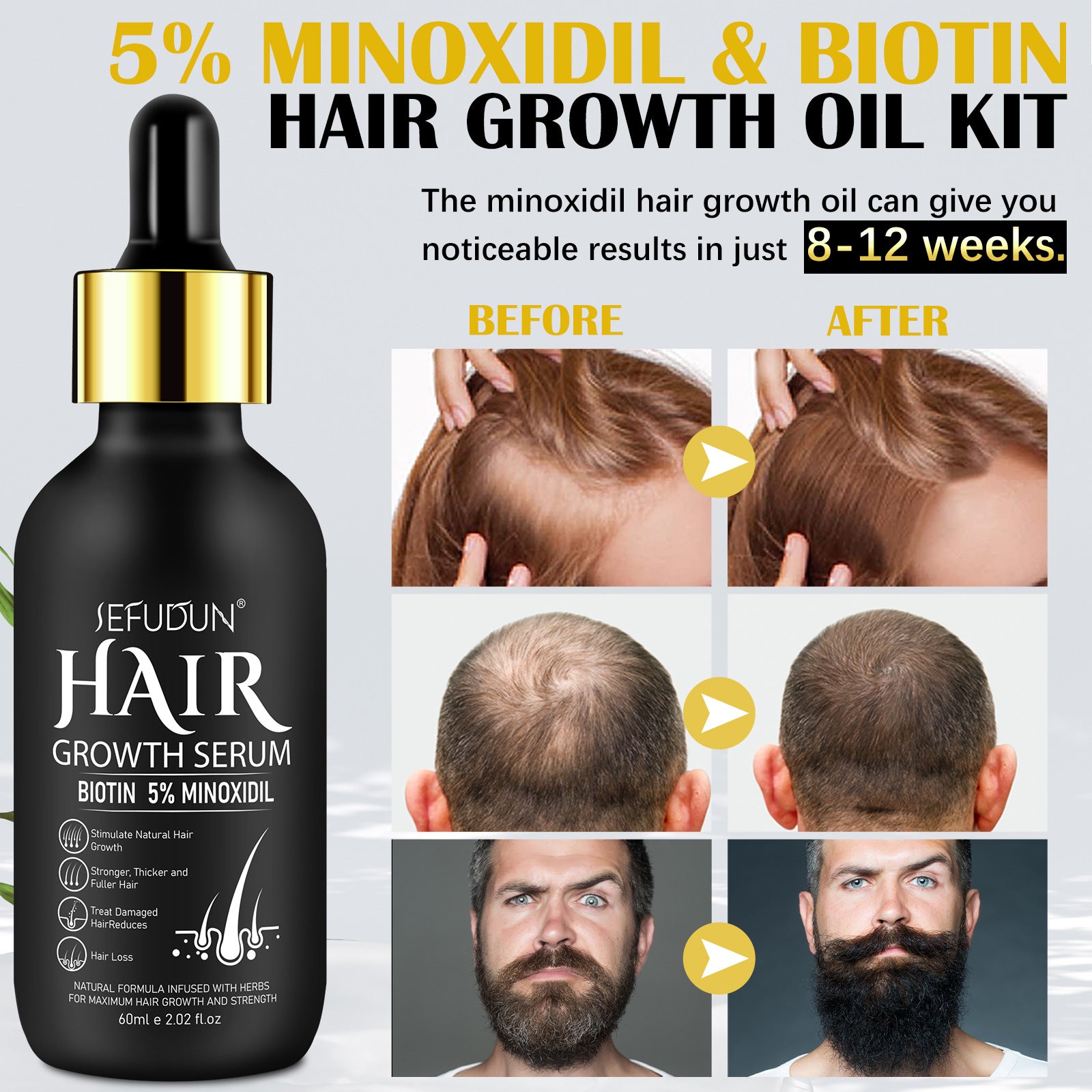 SEFUDUN Hair Growth Serum + Derma Roller Kit