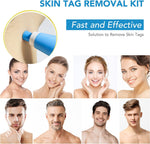 ALIVER 2in1 Blue Skin Tag Removal Kit