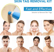 ALIVER 2in1 Blue Skin Tag Removal Kit