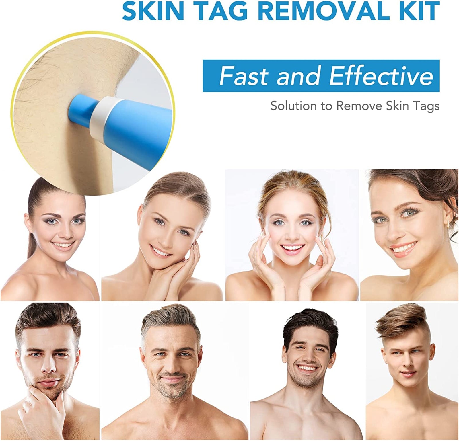ALIVER 2in1 Blue Skin Tag Removal Kit