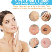 ELAIMEI Skin Tag Remover, Wart & Mole Body Liquid, 30ml