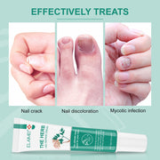 ELAIMEI Herbal Nail Repair Cream, 15g