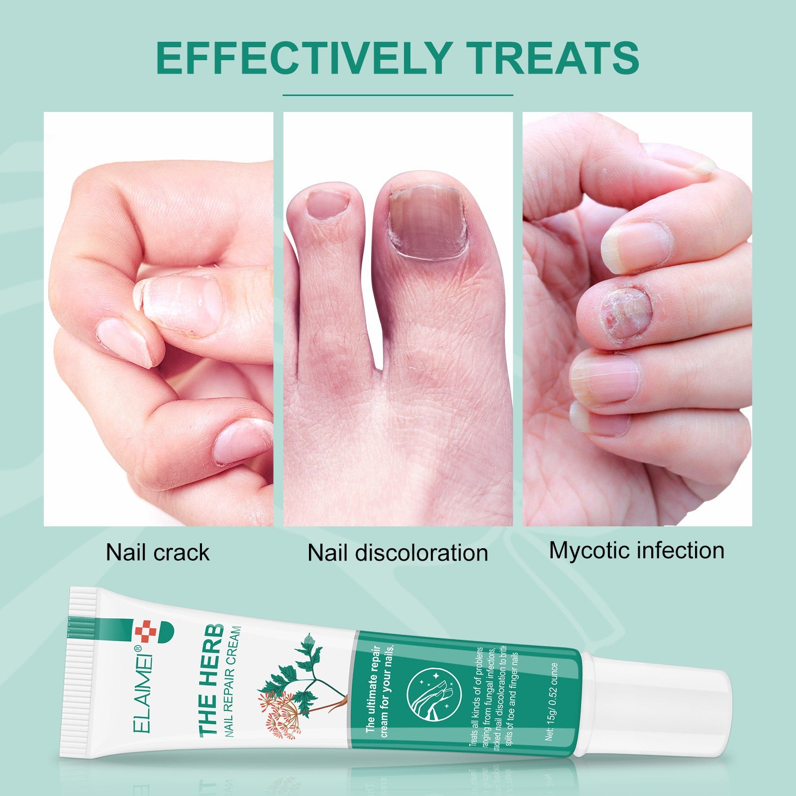 ELAIMEI Herbal Nail Repair Cream, 15g