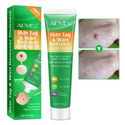 ALIVER Body Skin Tag & Wart Remover Ointment, 20g