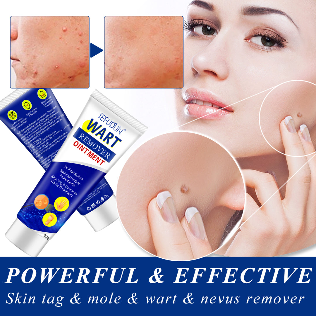 SEFUDUN Skin Tag & Wart Removal Cream, 20g