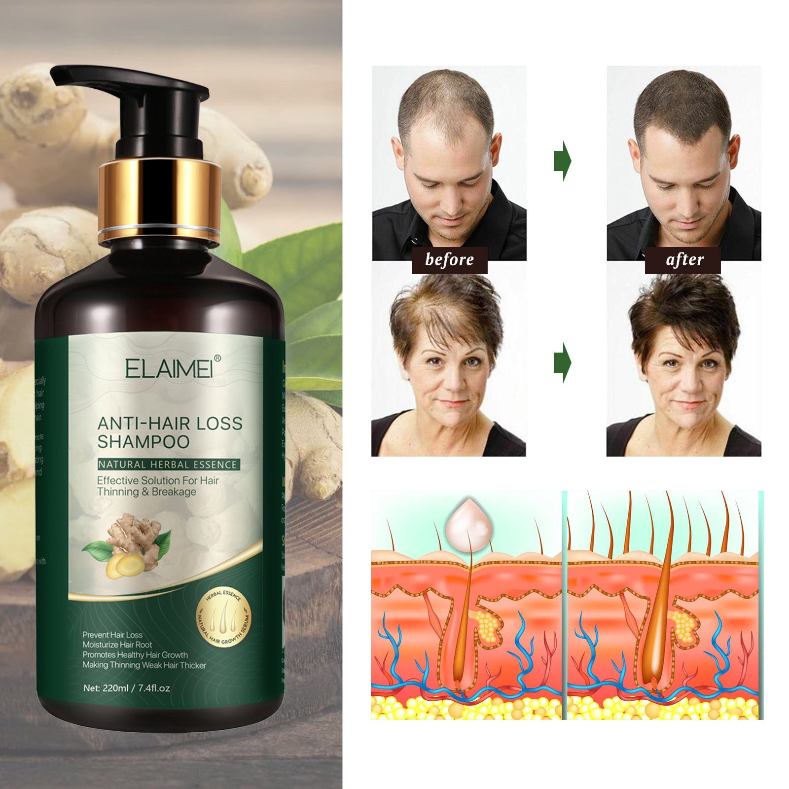 Elaimei Anti Hair Loss Treatment Shampoo for Men Women