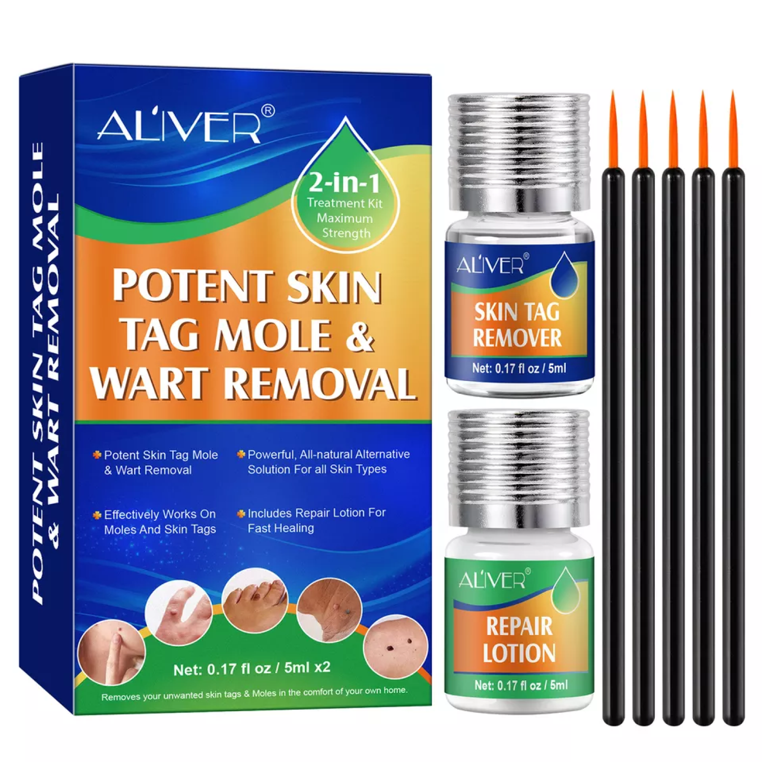 ALIVER 2in1 Effective Body Skin Tag Mole & Wart Removal Kit