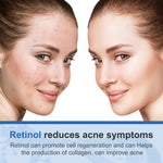 ELAIMEI 2,5% Pure Retinol Cream for Face