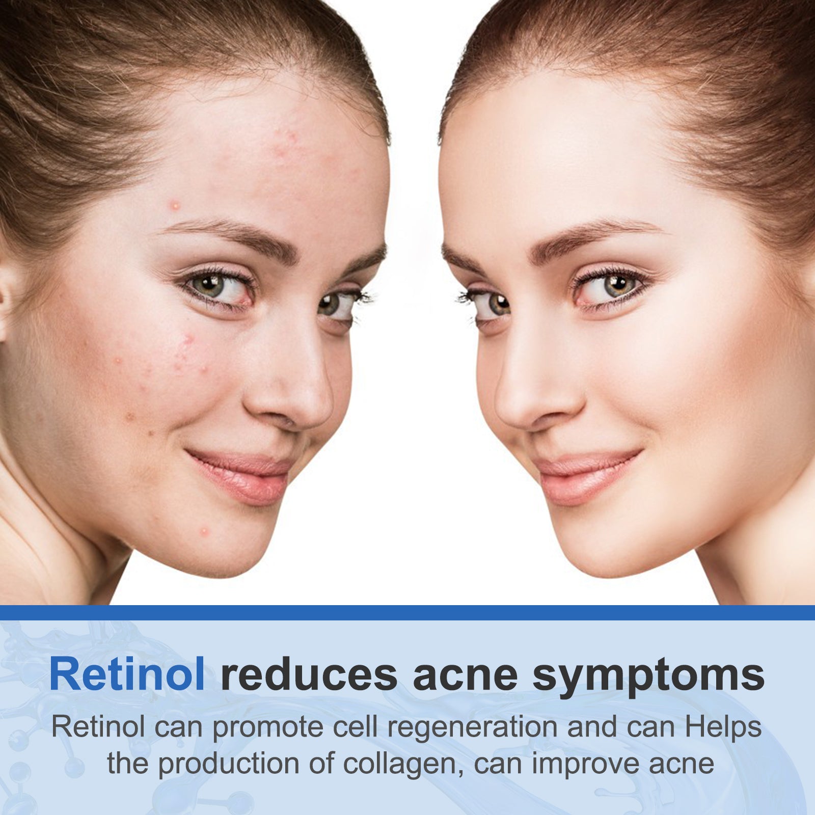 ELAIMEI 2,5% Pure Retinol Cream for Face