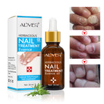 Aliver Fungus Nail Anti Fungal Infection Oil Treatment