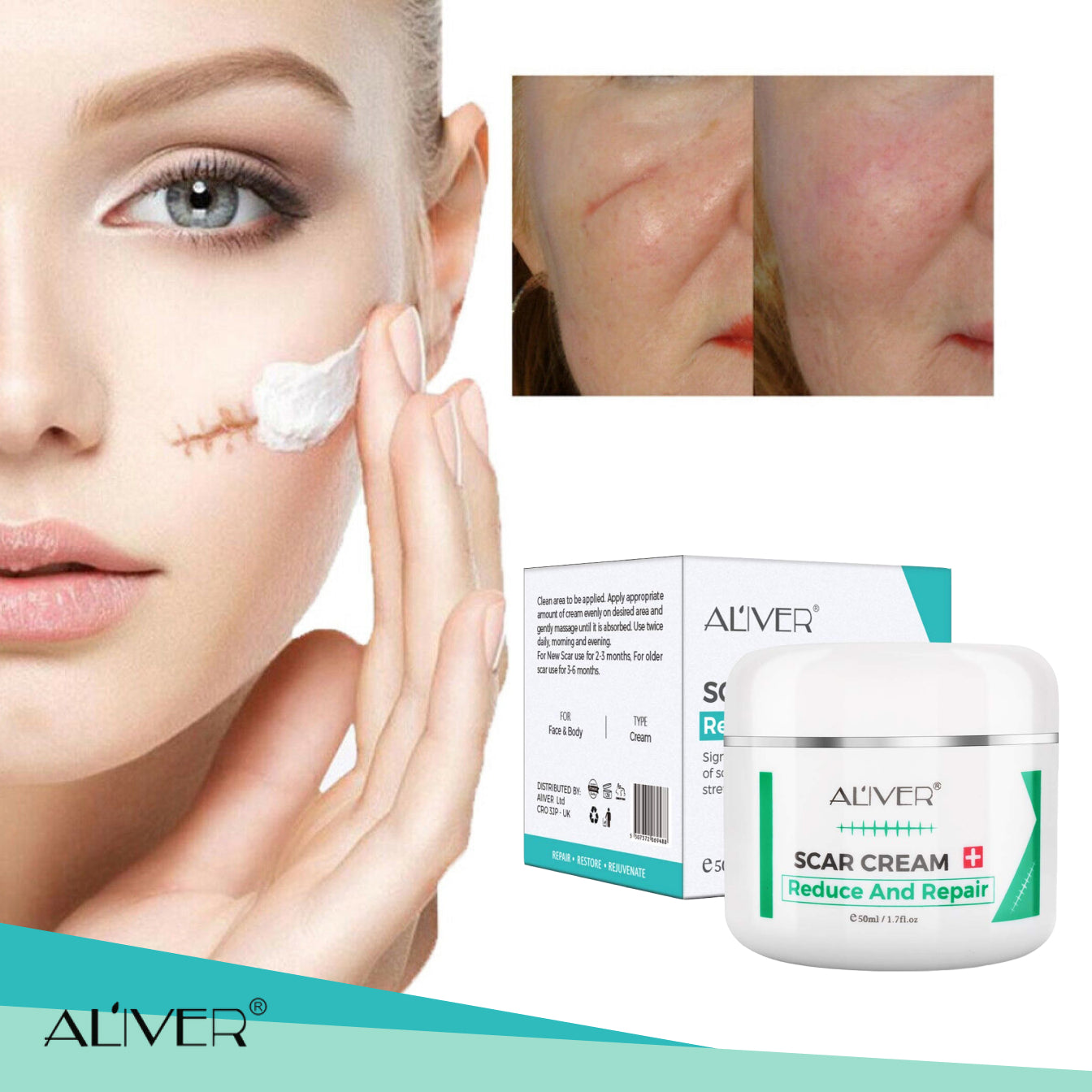 Aliver Treatment Scar Remove Cream for Body Face Skin