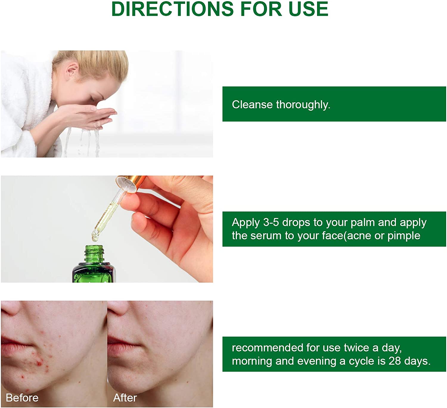 ELBBUB Acne Spot Treatment Serum, Tea Tree, 17ml