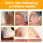 ALIVER Ginseng Soft Foot Peel Mask for Dry Cracked Feet
