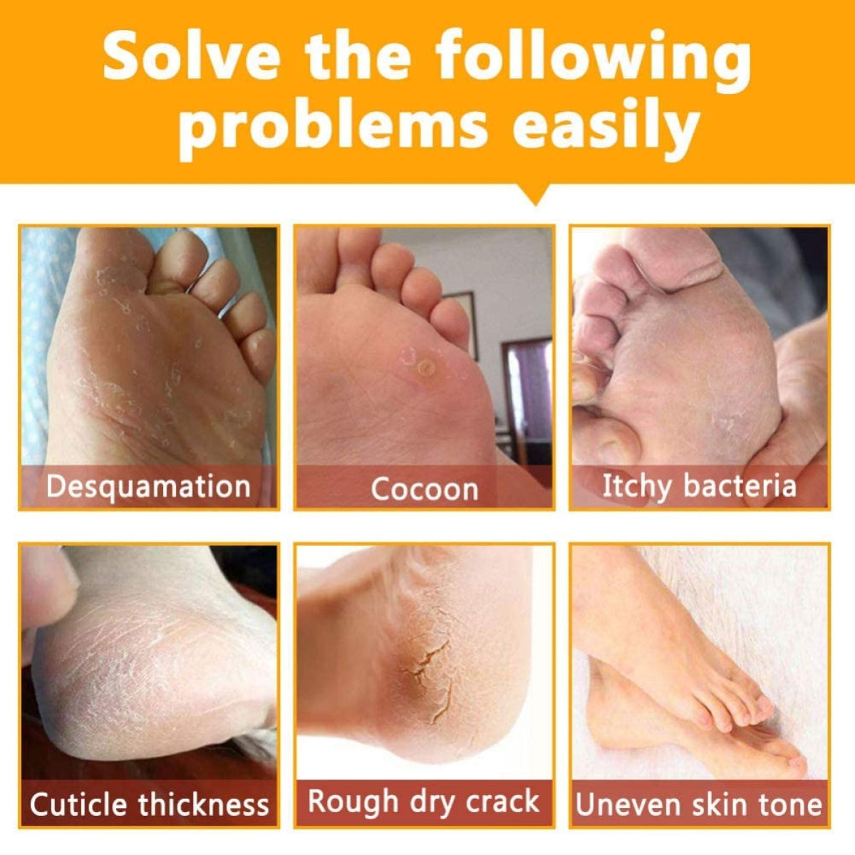 ALIVER Ginseng Soft Foot Peel Mask for Dry Cracked Feet