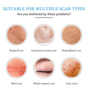 REVIGLAN TCM Scar And Acne Mark Removal Gel Ointment, 30g