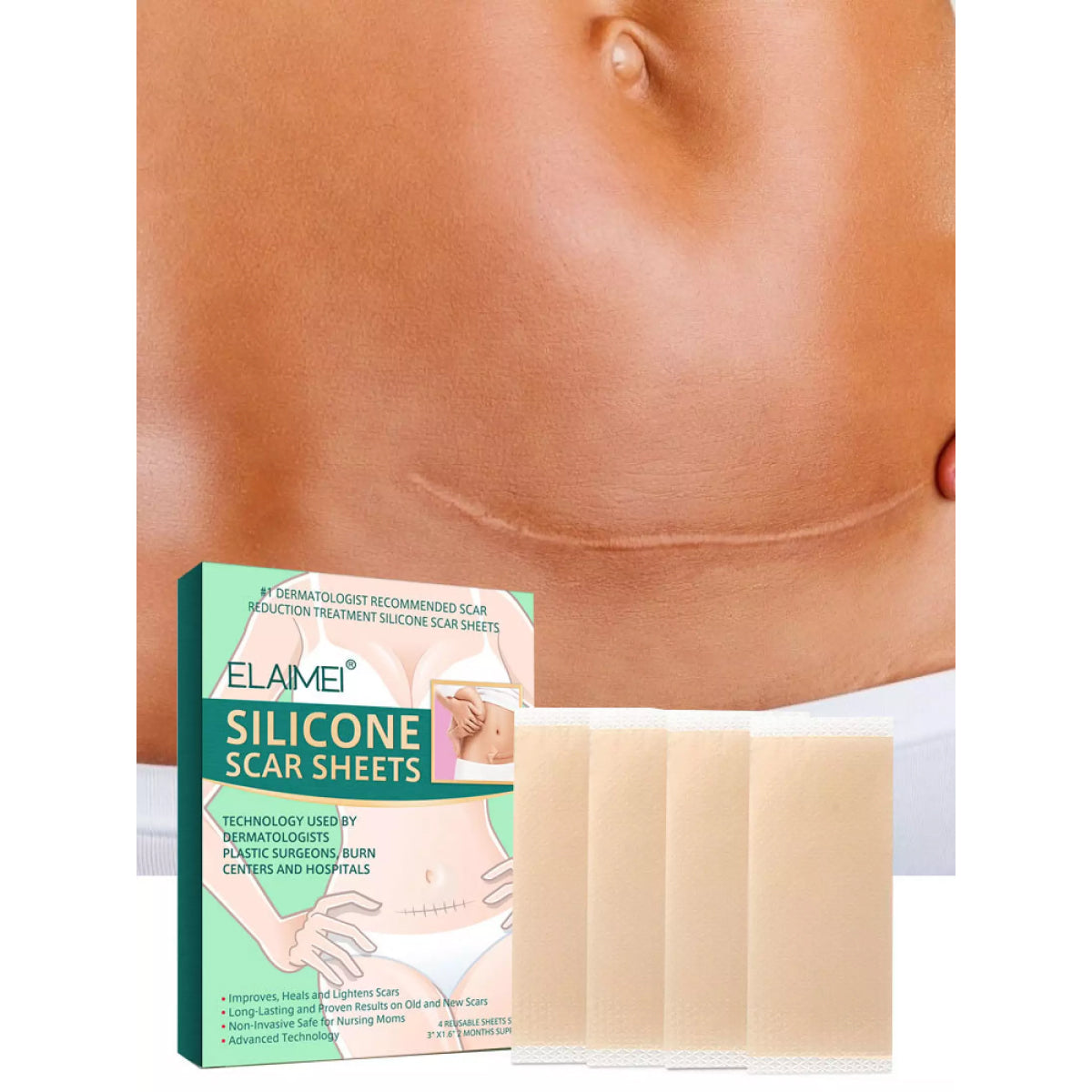 Elaimei Silicone Sheets for Scar Removal