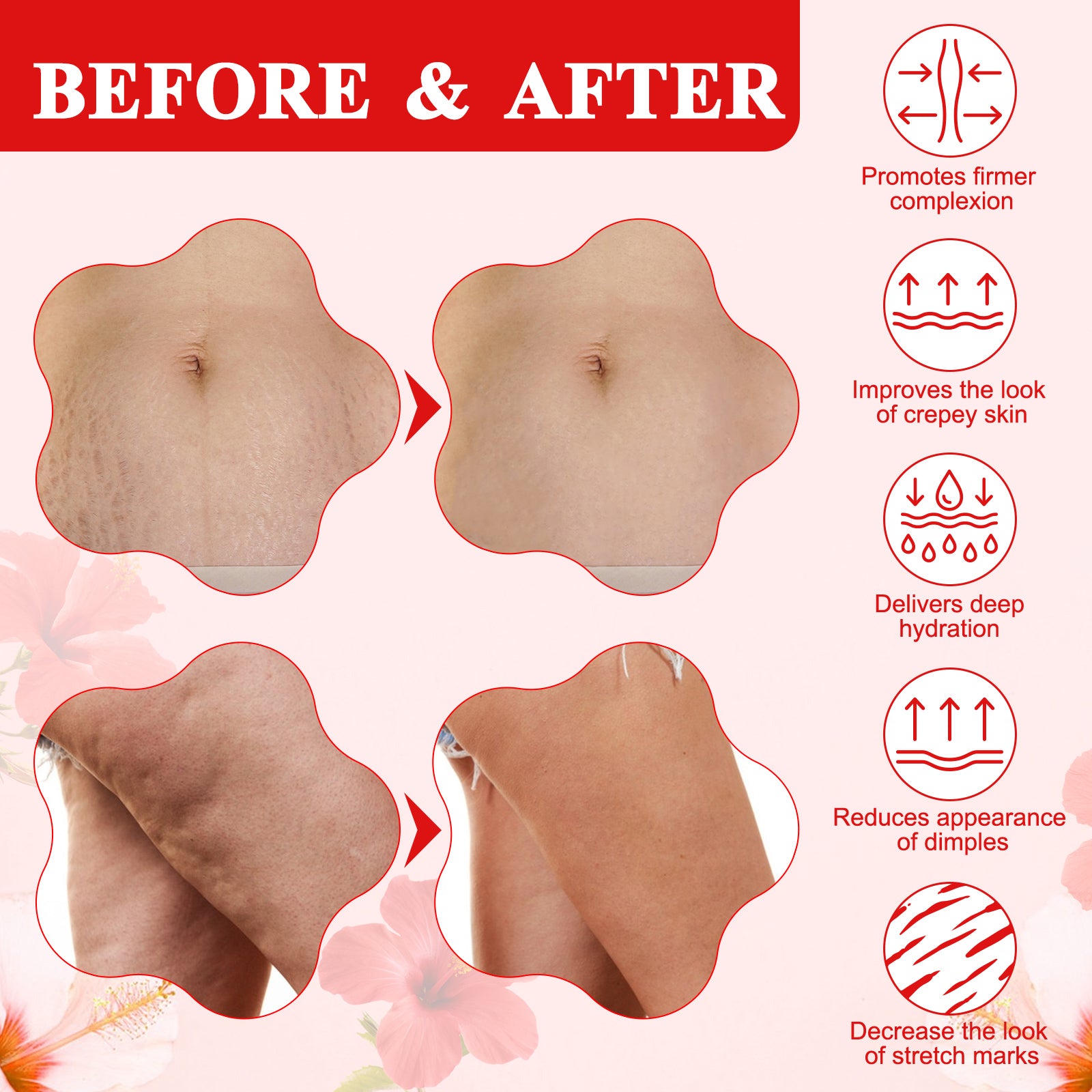 ELAIMEI Hibiscus & Honey Belly Firming Cream, 80ml