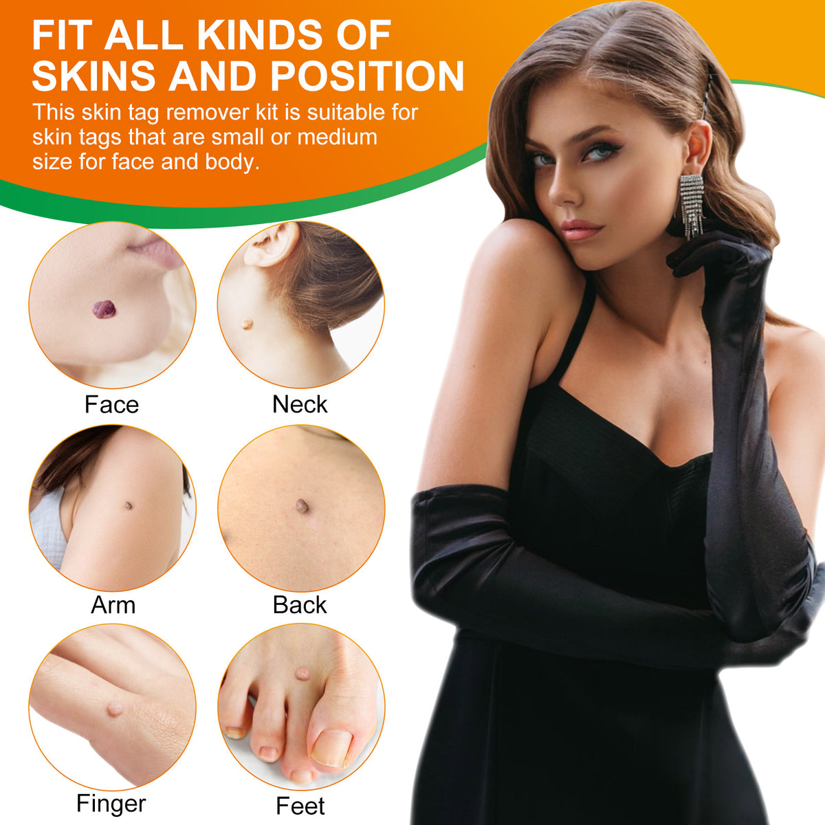ALIVER Orange Skin Tag Remover Kit