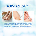 SEFUDUN Removal Paronychia Oil, 30ml