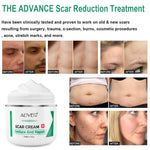 Aliver Treatment Scar Remove Cream for Body Face Skin
