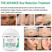 Aliver Treatment Scar Remove Cream for Body Face Skin