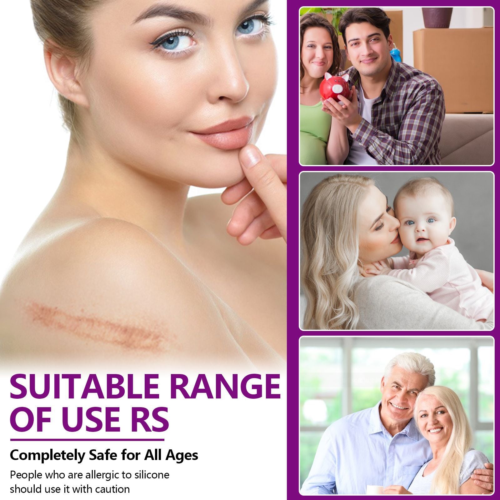 Elaimei Silicone Scar Removal Gel Tape Roll for Skin Treatment Repair 1.5 m