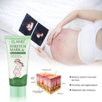ELAIMEI Anti Stretch Mark Cream, 60ml