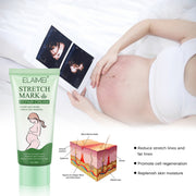 ELAIMEI Anti Stretch Mark Cream, 60ml