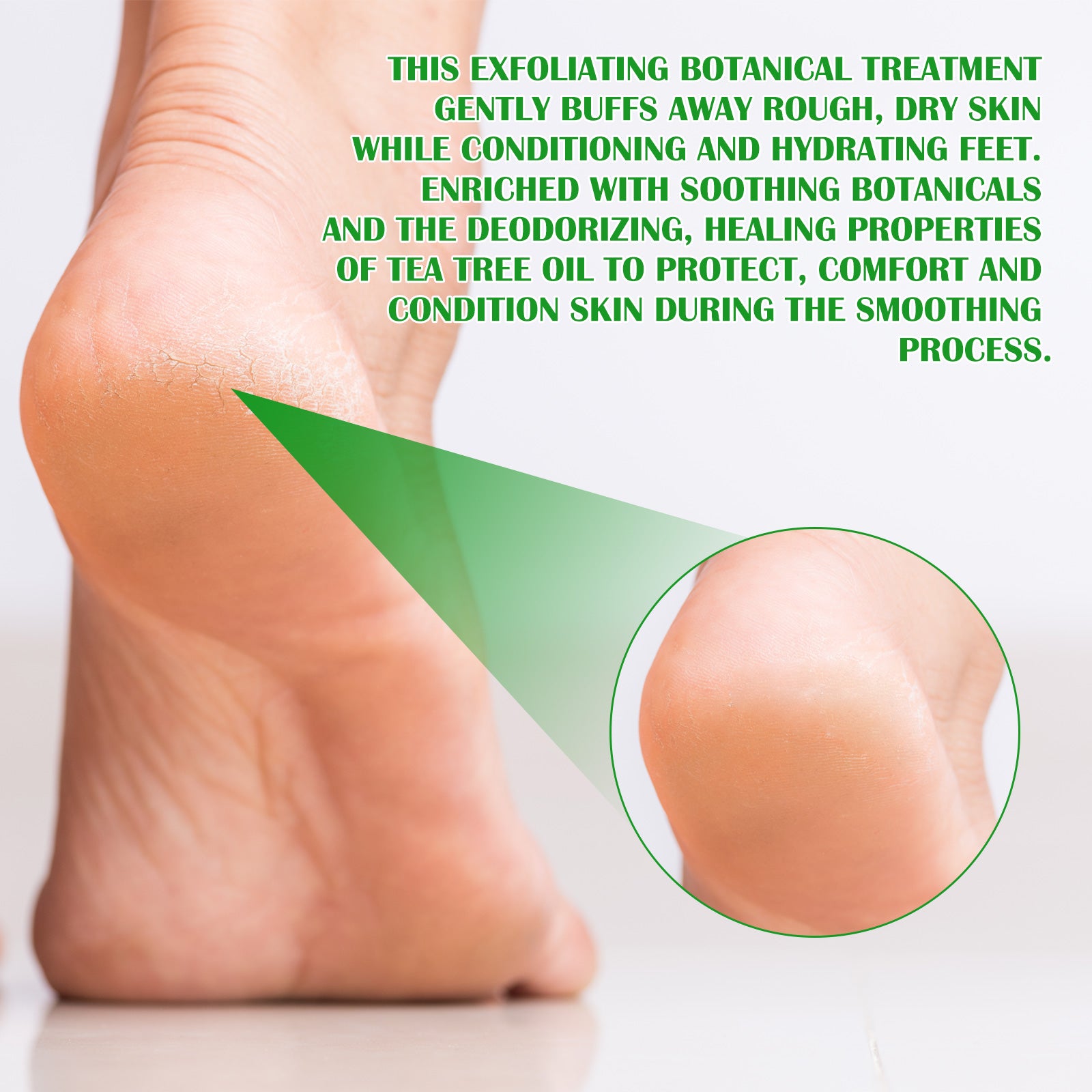 ELAIMEI Exfoliating Foot Peeling Spray with Green Tea Oil, 100ml